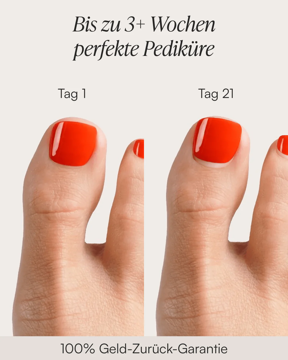 Cheesecake Mani & Pedi Set Strisce in Gel UV - Image 6