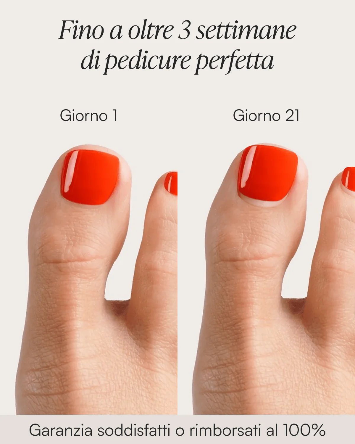 Mon Cheri Pedicure Strisce in Gel UV - Image 4